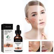 Facial Melanin Repair