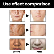 Facial Melanin Repair