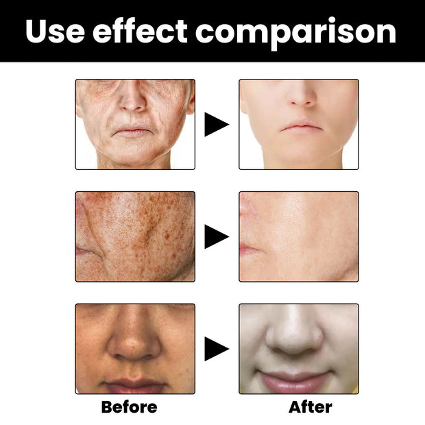 Facial Melanin Repair