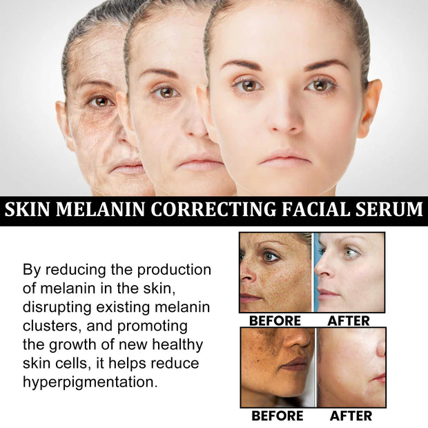 Facial Melanin Repair